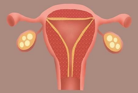 子宮內(nèi)膜薄總懷不上？