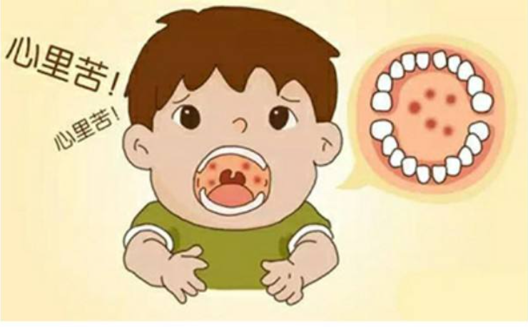 夏季高發(fā)的這種病不是口腔潰瘍！